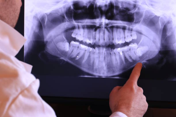 Best Emergency Dental Care for Broken or Chipped Teeth in Berry Hill, TN