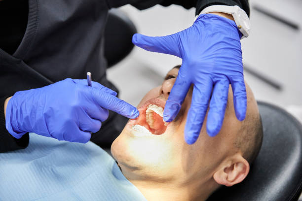 Best Emergency Tooth Extraction in Berry Hill, TN